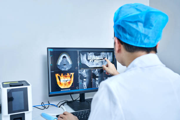 Best Emergency Dentist for Lost Fillings or Crowns in Olney, MD
