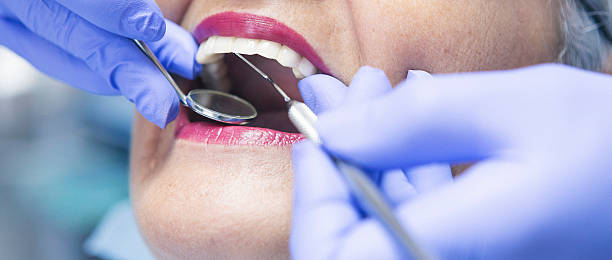 Best Emergency Root Canal Treatment in Olney, MD